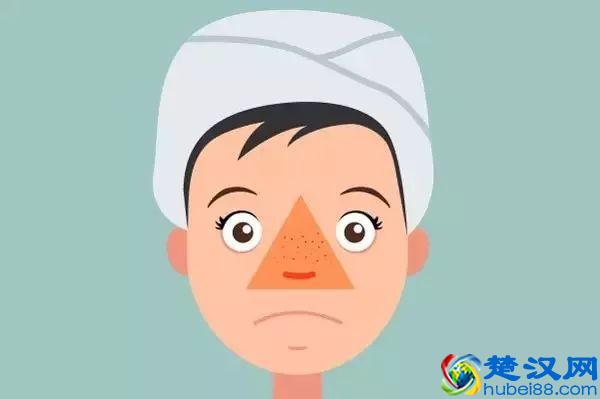 手欠的人请注意！皮肤科医生教你3招去黑头