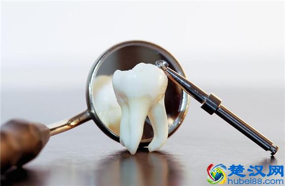 长蛀牙怎么办 5大方法助你解决难题