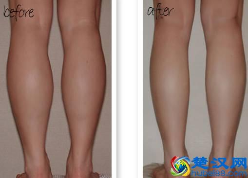 肌肉型小腿顽强难减？试试这个方法！