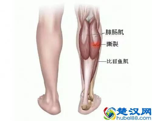 肌肉型小腿顽强难减？试试这个方法！