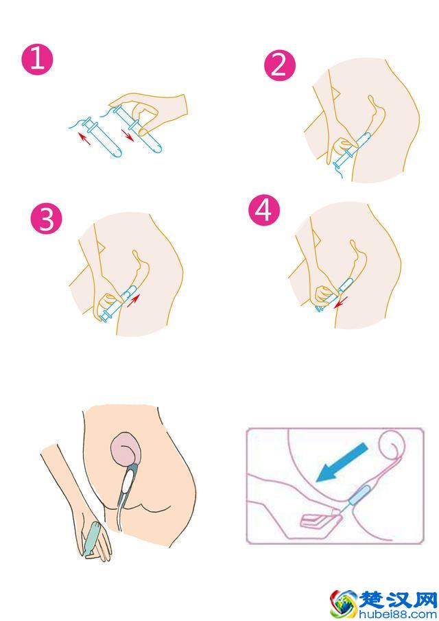 卫生棉条是什么?卫生棉条真的好用吗?