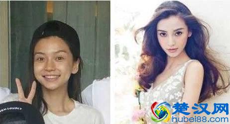 明星们都在用美白针，什么样的美白针好，效果如何？