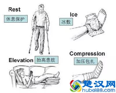 骨科科普：脚踝扭伤了怎么办？别再揉了，这才是正确处理方式！