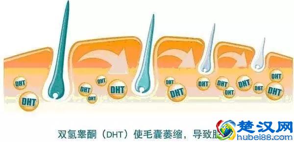 原来脂溢性脱发可以这么治，很多发友都收藏了！