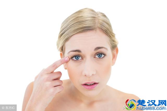 鱼尾纹严重怎么办？5个方法，帮你消除岁月的痕迹！