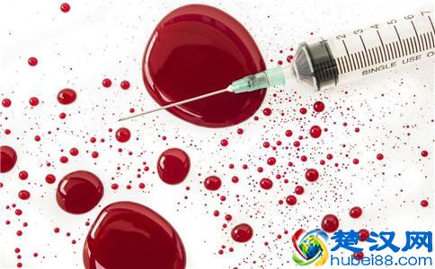 熊猫血是什么 熊猫血的人有什么特征