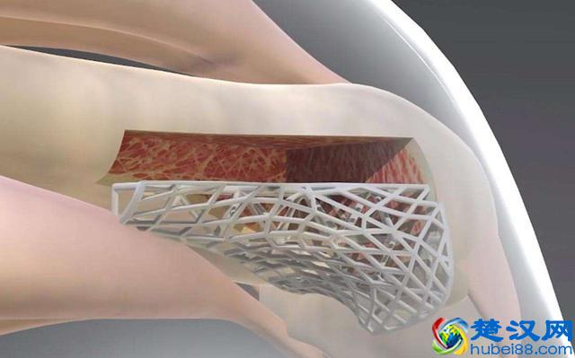 3D打印技术是如何流行的，为什么这几年突然就“销声匿迹”了？