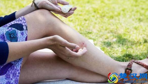 蚊子最喜欢咬哪种血型的人？最靠谱的驱蚊止痒方法都在这了