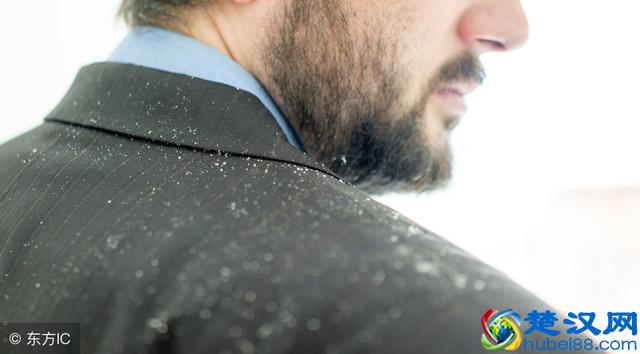 头屑多是什么原因引起的？怎么有效调理？一篇文章为你说清楚