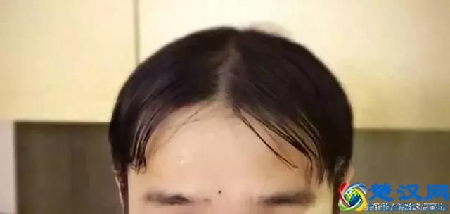 发际线高的男生,有什么发型可以拯救你的大额头?