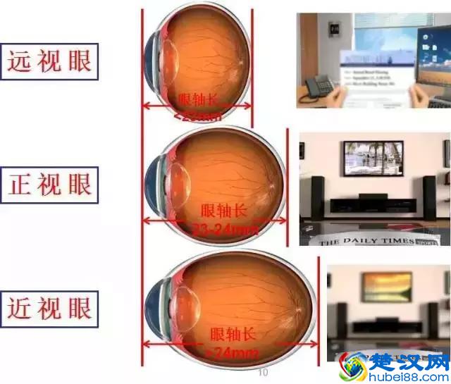 8大近视常见问题，全球父母都在关注，收藏起来吧