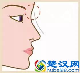鼻子被撞成了“塌鼻子”怎么办？