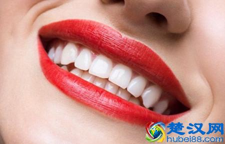 牙列稀疏怎么办？这些问题你要知道！