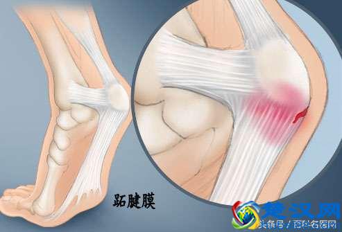 脚后跟疼痛，不红不肿是怎么回事？原因有哪些？