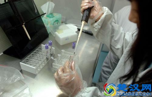 现在做亲子鉴定最简单实用的方法是什么