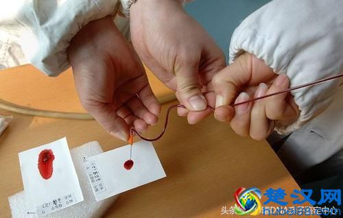 现在做亲子鉴定最简单实用的方法是什么