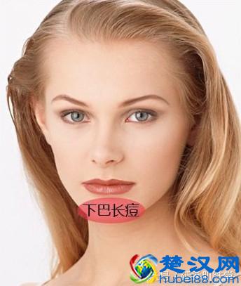 中药方：为什么下巴总是长痘？专家告诉你身体是哪里出了问题！