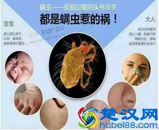 中药方：为什么下巴总是长痘？专家告诉你身体是哪里出了问题！