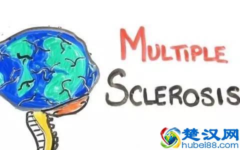 左眼跳是什么预兆，左眼跳小心是这4种疾病