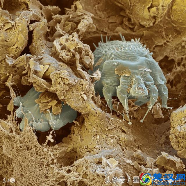 螨虫清除方：脸上攒了一夏天的螨虫，是时候排出来了