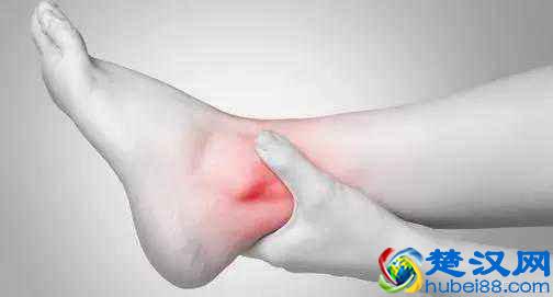 骨科科普：脚踝扭伤了怎么办？别再揉了，这才是正确处理方式！