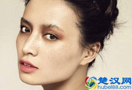 满脸色斑肤色暗沉，教你5个淡化色斑的方法