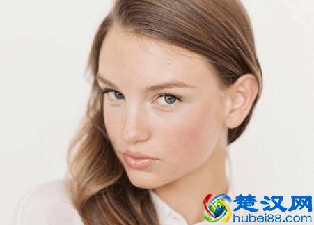 满脸色斑肤色暗沉，教你5个淡化色斑的方法