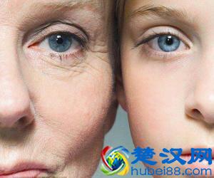 如何去眼角纹 做好这几步打造无暇眼周