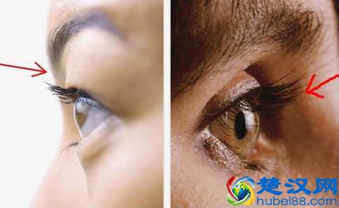 眼窝凹陷怎么办？这样做，眼睛瞬间电力十足