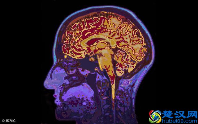 辟谣！磁共振检查一定比CT好吗？其实，磁共振也有缺点