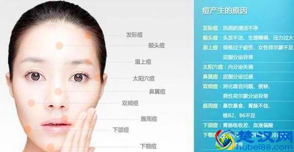 额头上总是长痘痘，怎么办?