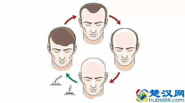 脱发能根治吗？脱发一般可以治疗，对症治疗很关键