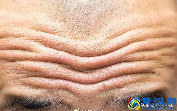 很多人都有抬头纹，那么在相学中抬头纹对我们的运势有什么影响呢