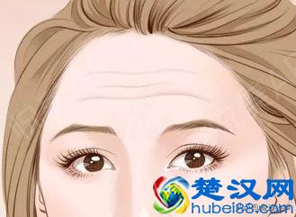 很多人都有抬头纹，那么在相学中抬头纹对我们的运势有什么影响呢