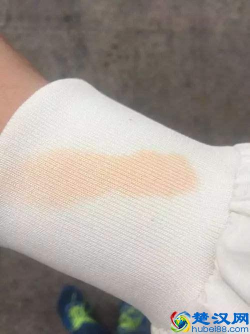 衣服沾上辣椒油不易清洗,教你几招,分分钟就搞定