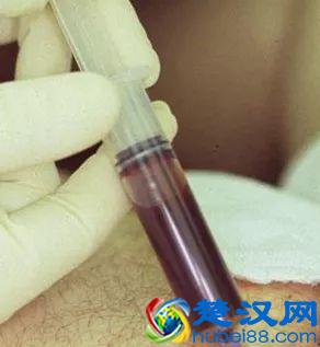 重口味预警：原来尸斑居然有这么多颜色