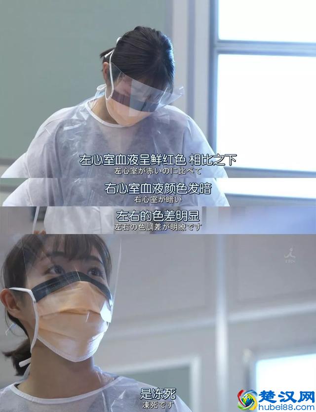 重口味预警：原来尸斑居然有这么多颜色