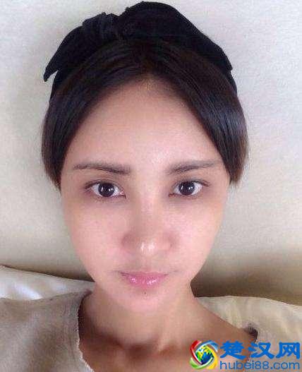 去除黑眼圈眼袋小窍门，对黑眼圈眼袋说拜拜