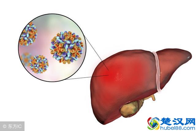 大三阳会传染，但不必远离大三阳患者，避开5个传播途径即可
