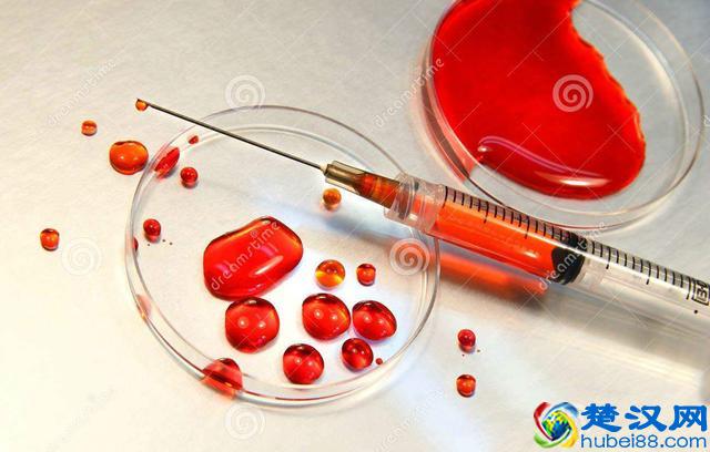 血小板升高或是肿瘤来敲门