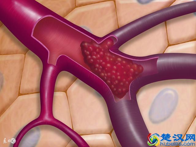 避孕药6大令人吃惊的副作用，你知道几个？