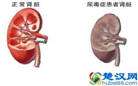 怀孕尿检白细胞偏高，有什么影响？