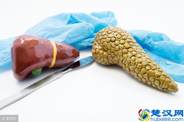 胆红素偏高，就是肝受损了？专家：还有这些原因不能小视