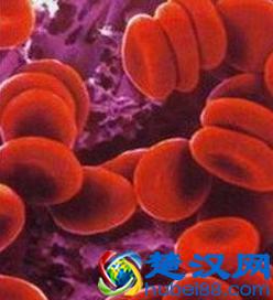 血小板偏低是什么原因症状主要有哪些