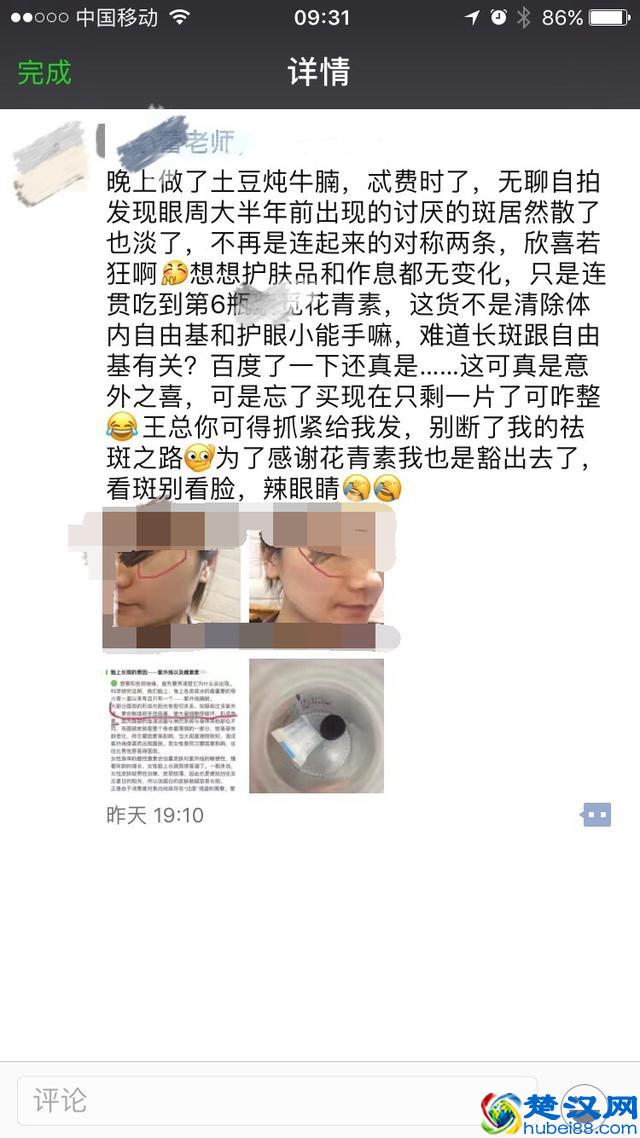 怎样才能使皮肤变好？变白？10年美白祛斑之路一招搞定