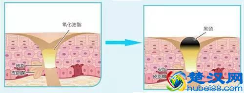 常做这件事，脸上毛孔变小，皮肤白皙细腻！