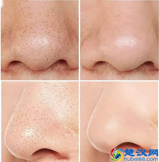 常做这件事，脸上毛孔变小，皮肤白皙细腻！