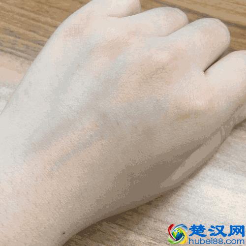 色斑三周就消失！我试了78种祛斑方法，最有效的不到就这1种！