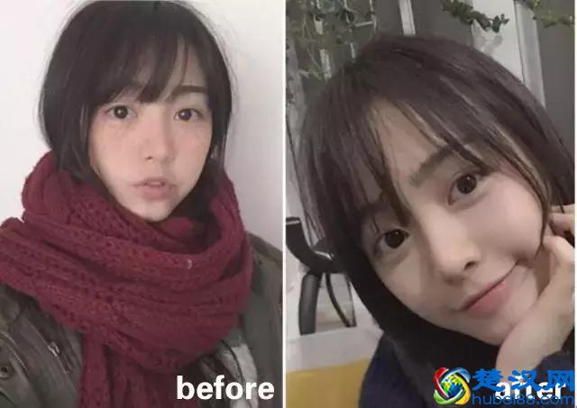 色斑三周就消失！我试了78种祛斑方法，最有效的不到就这1种！