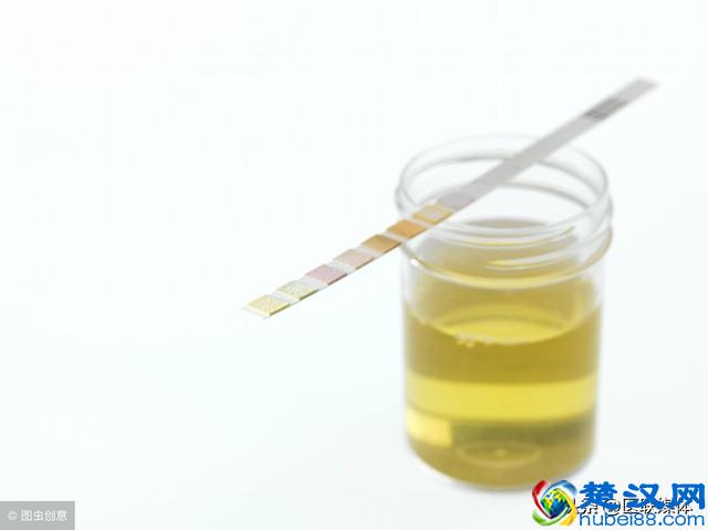 查出“酮体阳性”是什么意思？可能暗示了这些问题